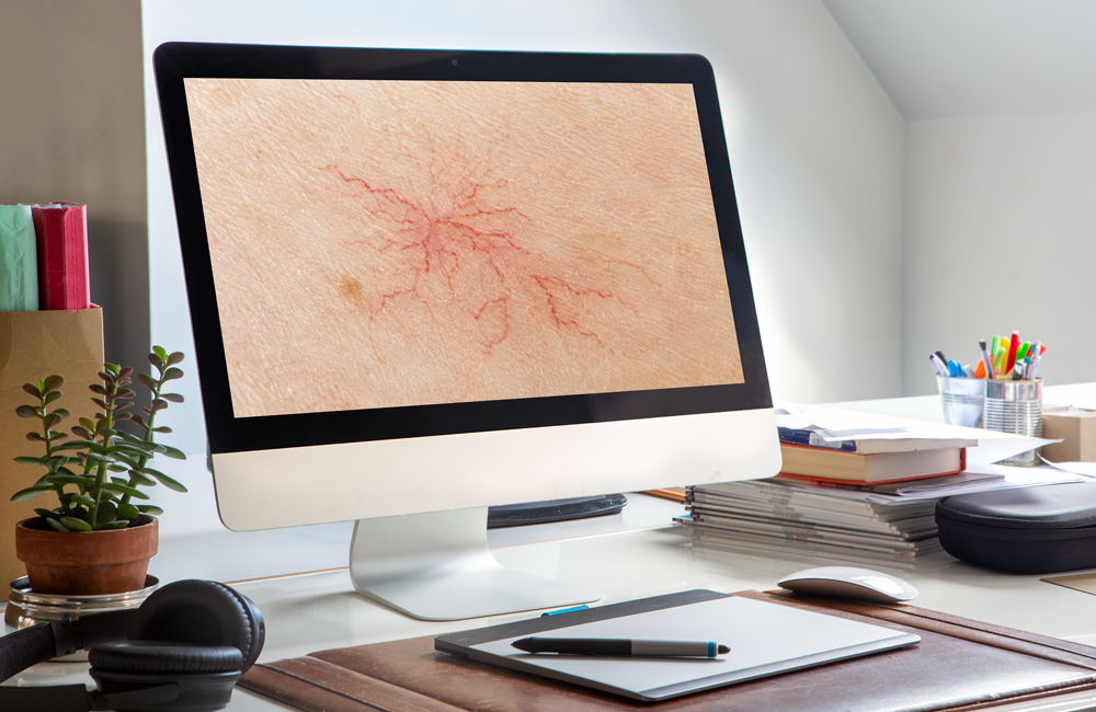 Angiodermatologie