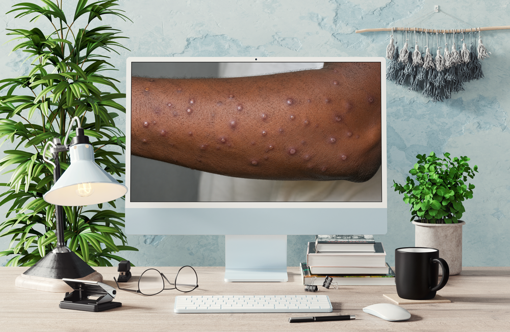 Dermatologie tropicale